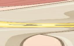 膝の痛み、、原因は「脂肪」かも！？